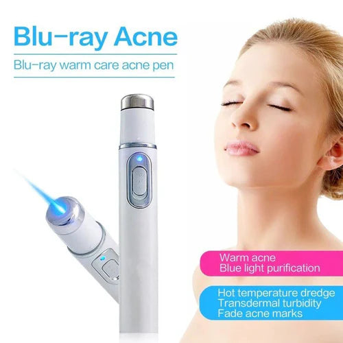 πβ¨ Blue-Ray Acne Treatment Pen