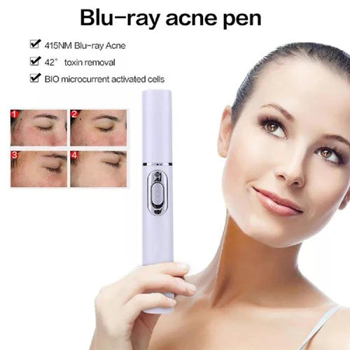 πβ¨ Blue-Ray Acne Treatment Pen