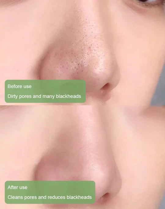 π΅ Green Tea & Charcoal Stick Mask β Million Pauline