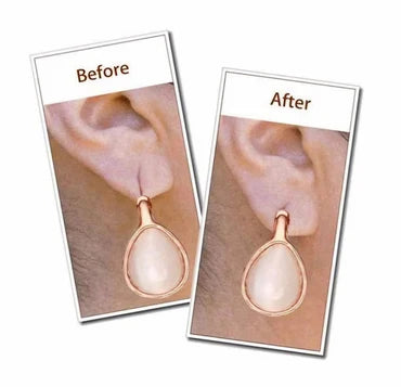 👂✨ Invisible EarLuxe Support Patches